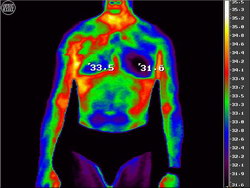 термограмма тела человека